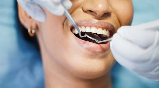 Best Cracked Tooth Emergency Dentist  in Savanna, IL