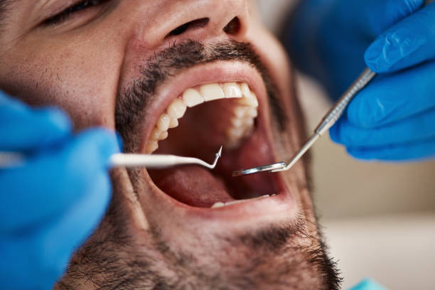 Best Dentist for Tooth Abscess  in Savanna, IL